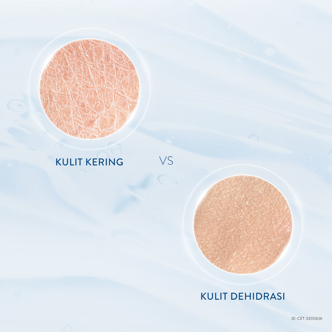 Kulit Kering vs Dehidrasi, Apa Bedanya?
